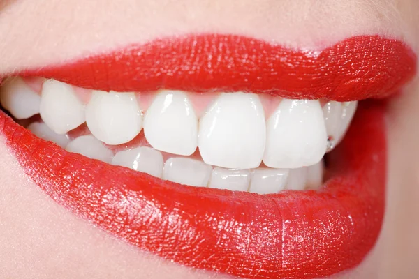Beautiful female mouth with white teeth — Stock Photo, Image