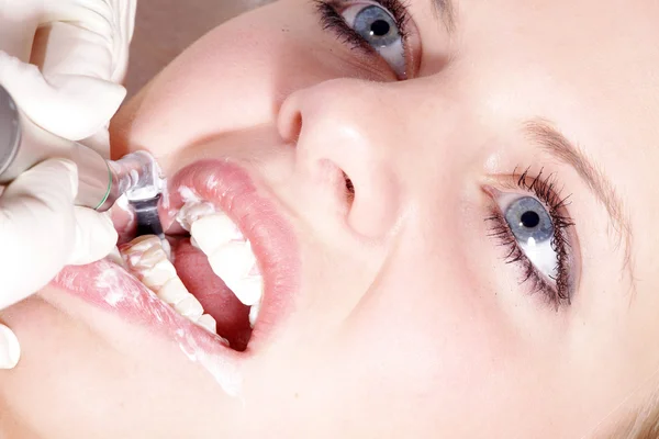 Καλλυντικά οδοντιατρική καθαρισμός — Φωτογραφία Αρχείου