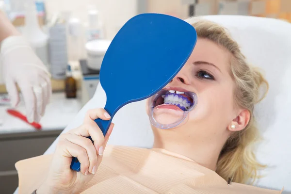 Nettoyage dentaire cosmétique — Photo