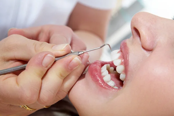 Kosmetische Zahnreinigung — Stockfoto