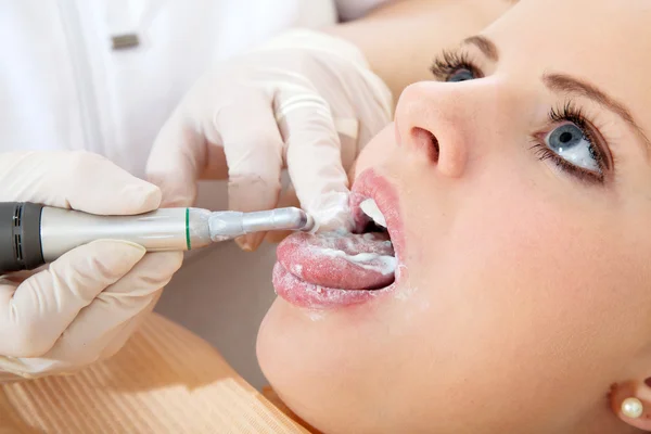 Limpieza dental cosmética — Foto de Stock