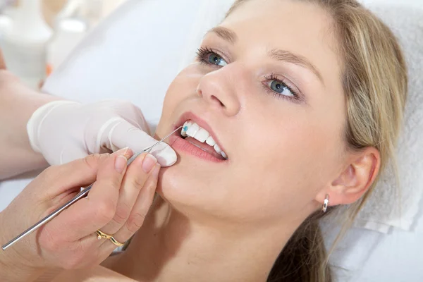 Limpeza dental cosmética — Fotografia de Stock