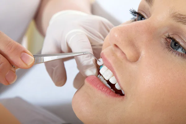 Cosmetic dental cleaning — Stock Photo, Image