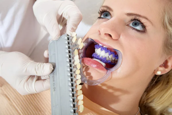 Cosmetic dental cleaning — Stock Photo, Image