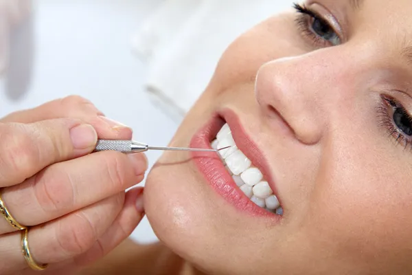 Kozmetikai fogászati takarítás Jogdíjmentes Stock Képek