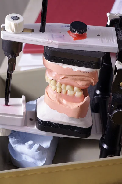 Jaw in the laboratory — Stock Photo, Image