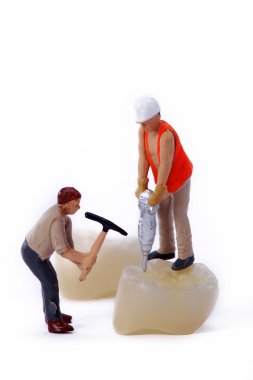 2 construction worker working on dental crown clipart
