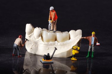 3 construction worker working on dental crown clipart