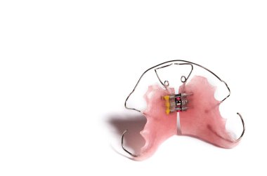 Pink orthodontic teeth retainer isolated on white background.
