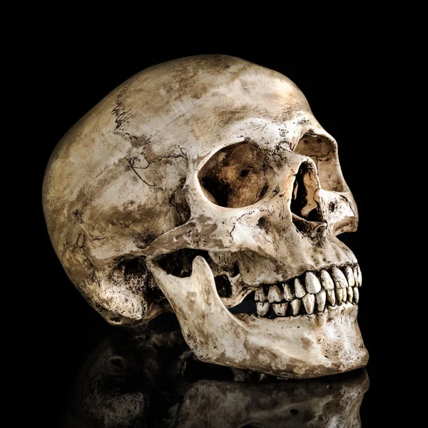 Human skull — Stock Photo, Image