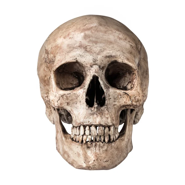 Human skull — Stock Photo, Image