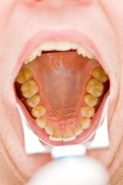 Фотография зубов — стоковое фото