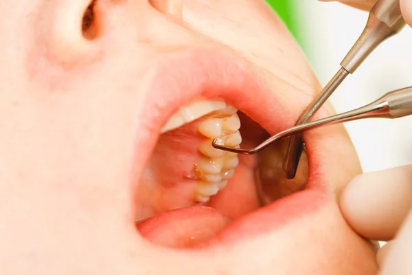 Examen dental — Foto de Stock