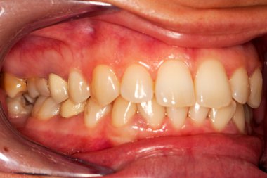 Human teeth clipart
