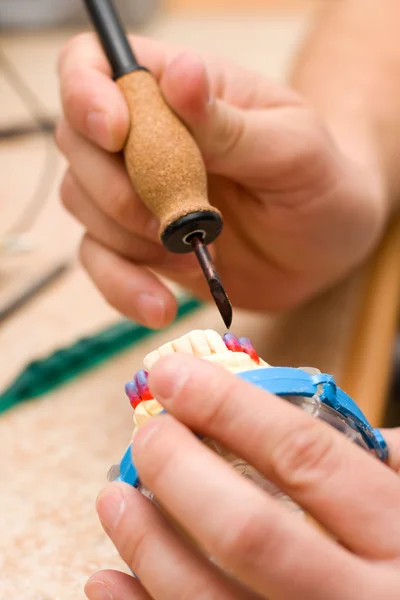 Ремоделювання зубів воску — стокове фото