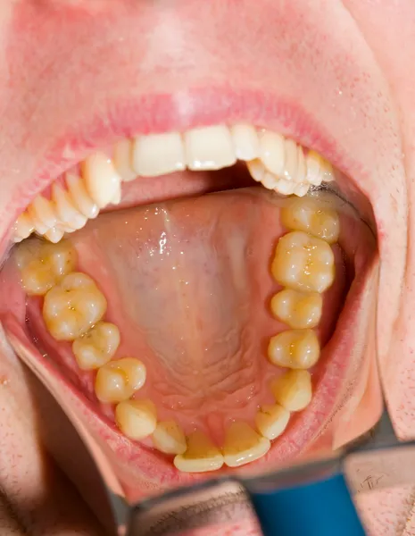 Fotografia dentale — Foto Stock