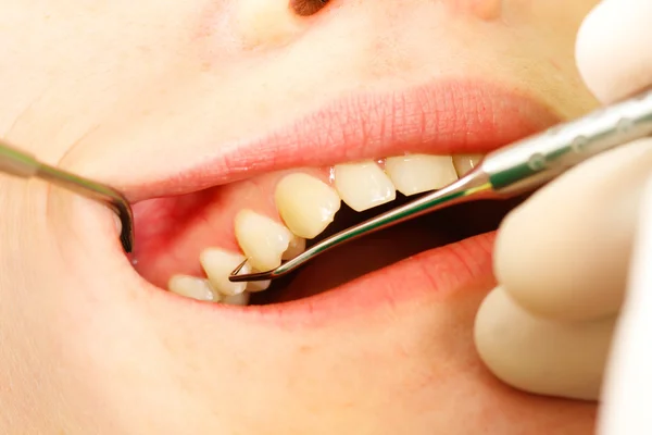 Examen dental — Foto de Stock