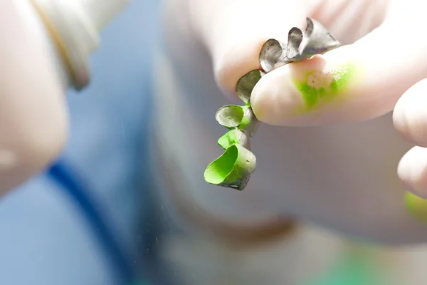 Preparazione per il ponte dentale — Foto Stock