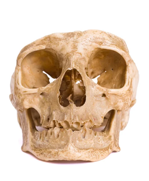 Bone-head — Stock Photo, Image