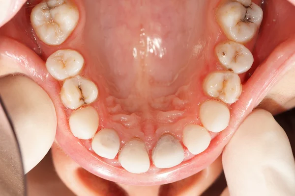 Dientes de circón ángulo raro — Foto de Stock