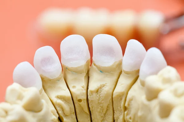 Dentystycznych cyrkon wciśnięty ceramiczne podstawy dla Stomatologia korony wykonane — Zdjęcie stockowe
