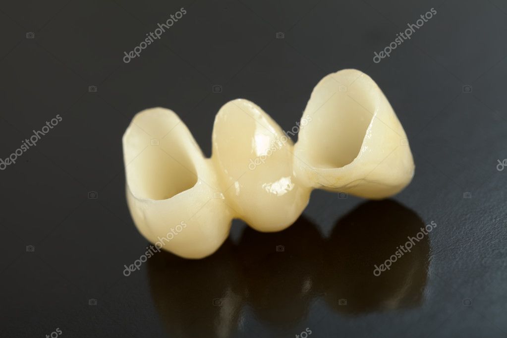Pressed ceramic teeth — Stock Photo © Lighthunter 20506917