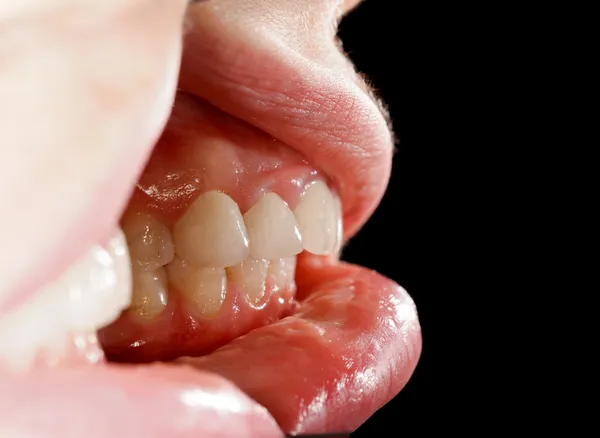 Streszczenie zębów — Zdjęcie stockowe