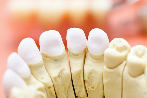 Denti di zircone — Foto Stock
