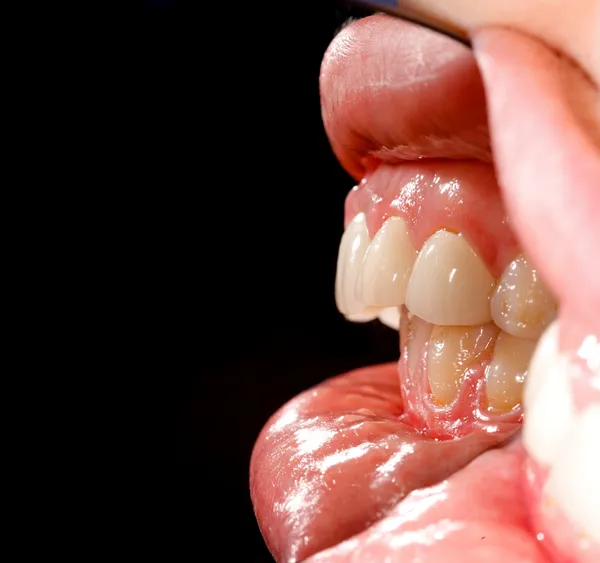 抽象的な歯 — ストック写真