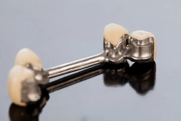 Ceramic crowns and dolder — Stockfoto