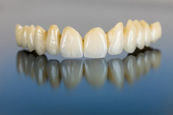 Porcelain teeth - dental bridge — Stock Photo, Image