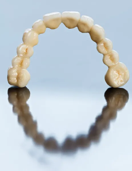 Dientes cerámicos - puente dental — Foto de Stock