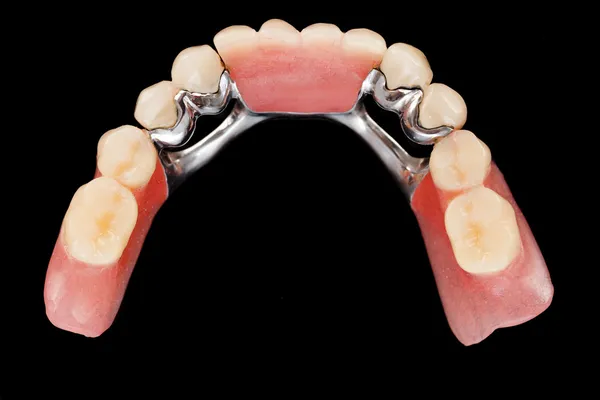 Dental skelett protes - övre vew — Stockfoto