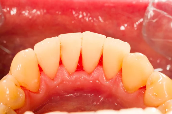 Denti inferiori — Foto Stock