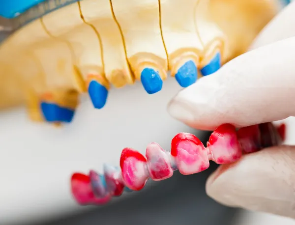 Dental Technician Working — Stock Photo, Image