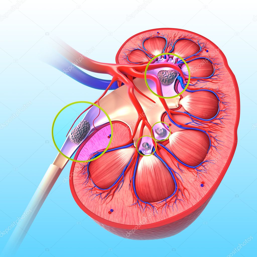 3d rendered illustration of kidney stone anatomy
