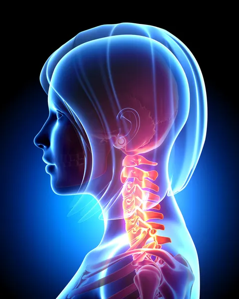 Female neck pain in blue — Stock Photo, Image