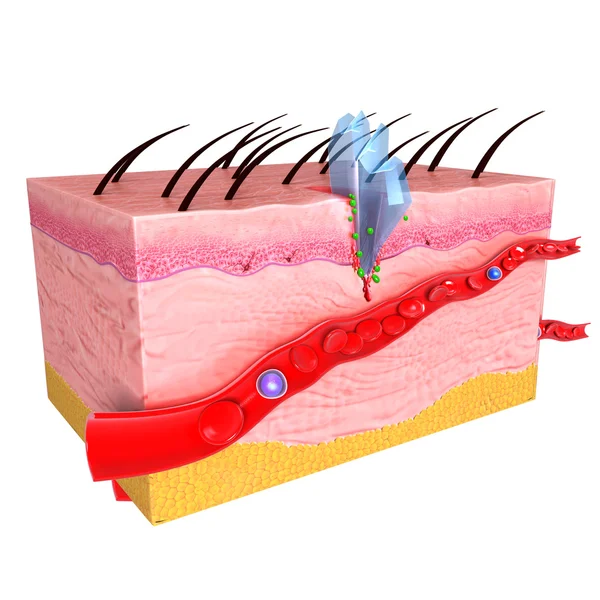 人类的皮肤免疫反应 — 图库照片