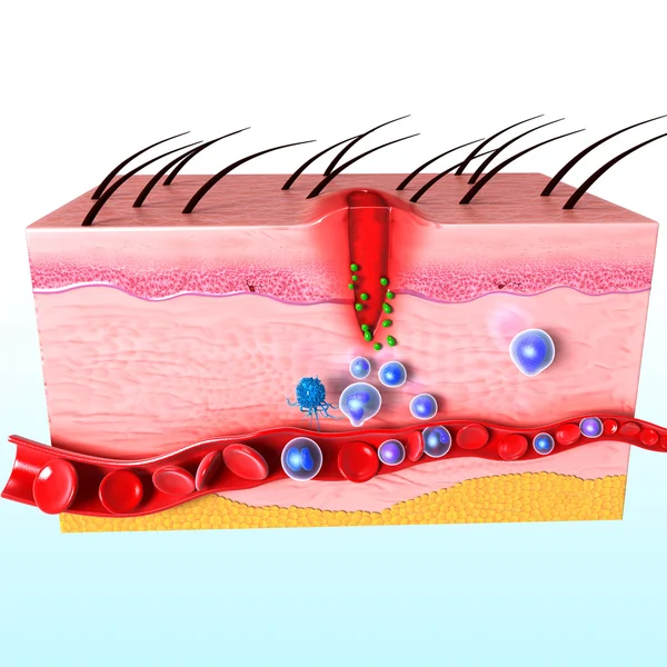 Immunreaktion der menschlichen Haut — Stockfoto