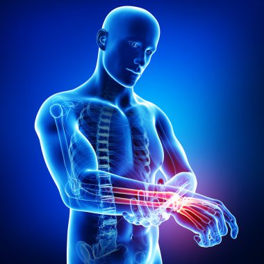 el ağrısı anatomisi