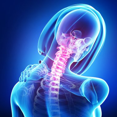 boyun ağrısı erkek x-ray