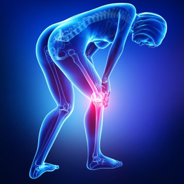 kadın diz ağrısı