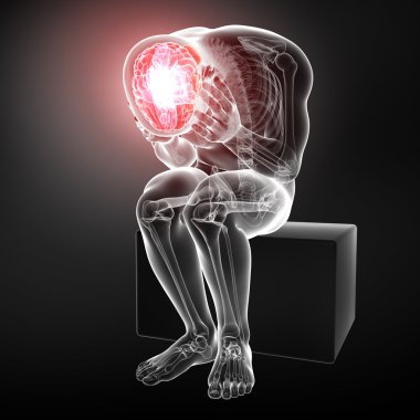 Beyin ağrısı anatomisi