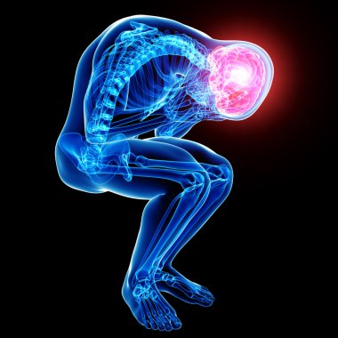 Beyin ağrısı anatomisi