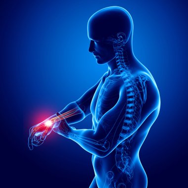 Mavi el ağrısı anatomisi