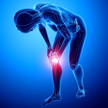 Mavili Kadın diz ağrısı