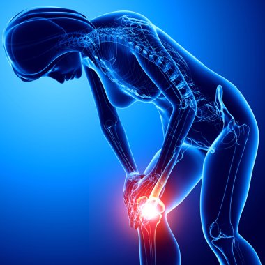 Mavili Kadın diz ağrısı