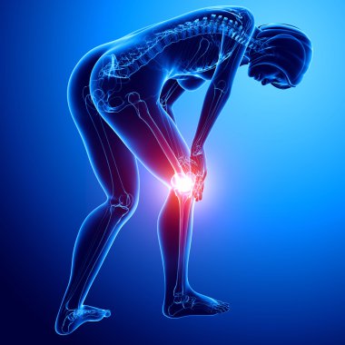 Mavili Kadın diz ağrısı