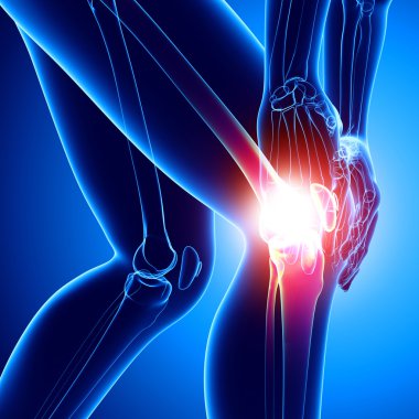 female knee pain in blue clipart