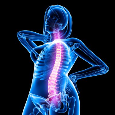 kadın omurga ağrısı x-ray anatomisi